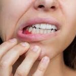 Common Dental Problems and How to Prevent Them Naturally