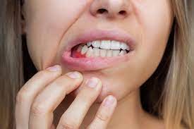Common Dental Problems and How to Prevent Them Naturally