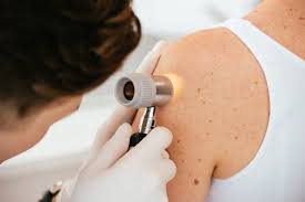 Dermatology in Skin Cancer Screening