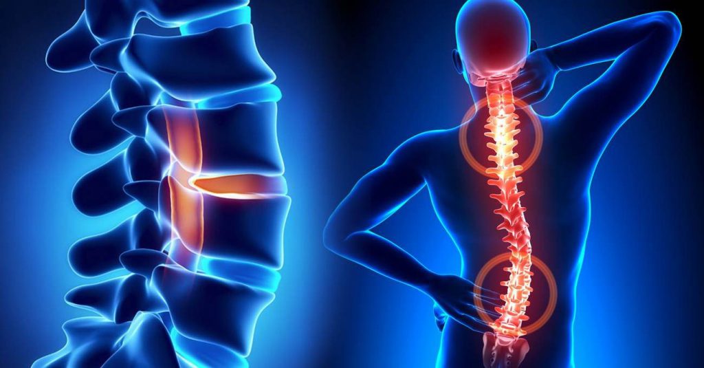 Spine Neurosurgeon
