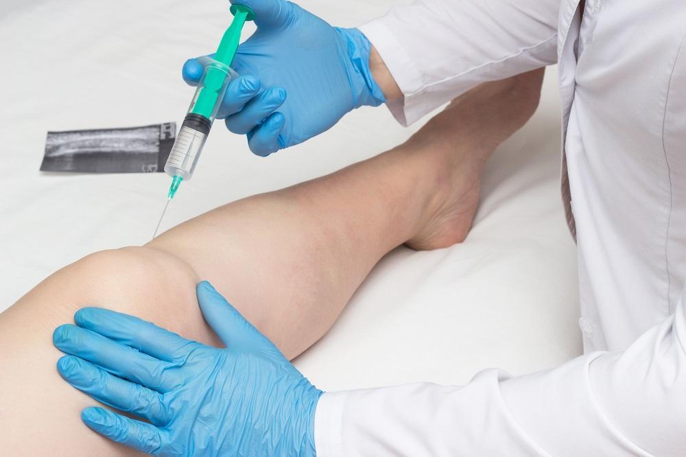 A Closer Look at the Procedure of Stem Cell Injections