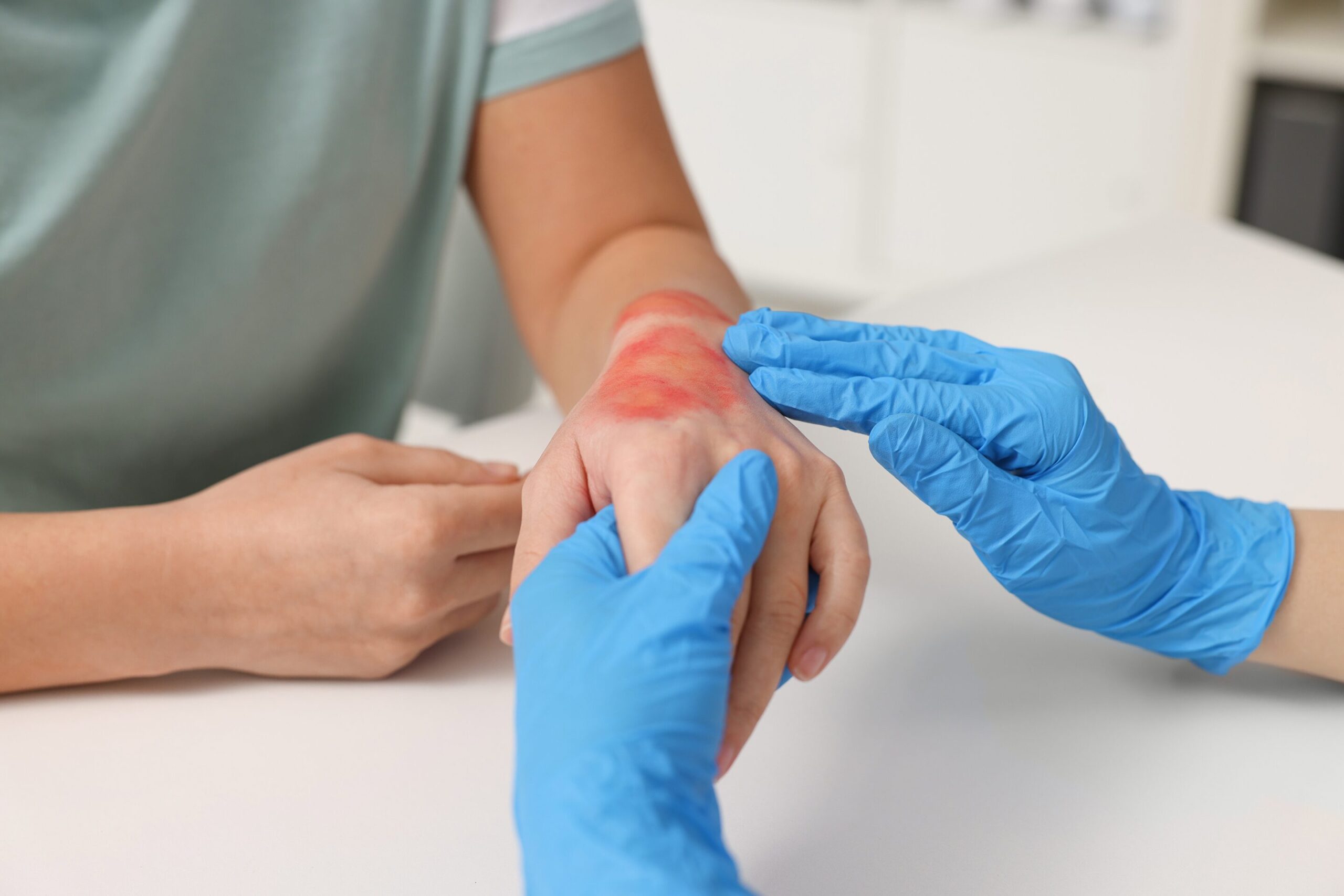 Effective Wound Care Management