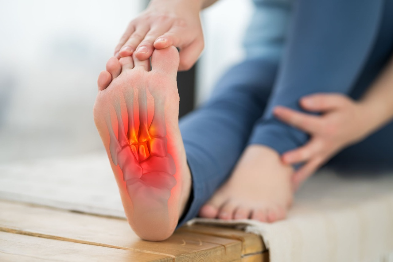 Plantar Fasciitis Relief